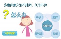多囊卵巢综合症怎么治疗好
