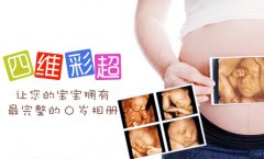 宿州做四维彩超多少钱?