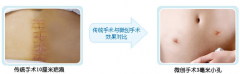 女性宫外孕的危害