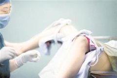 超导可视无痛人流多少钱？